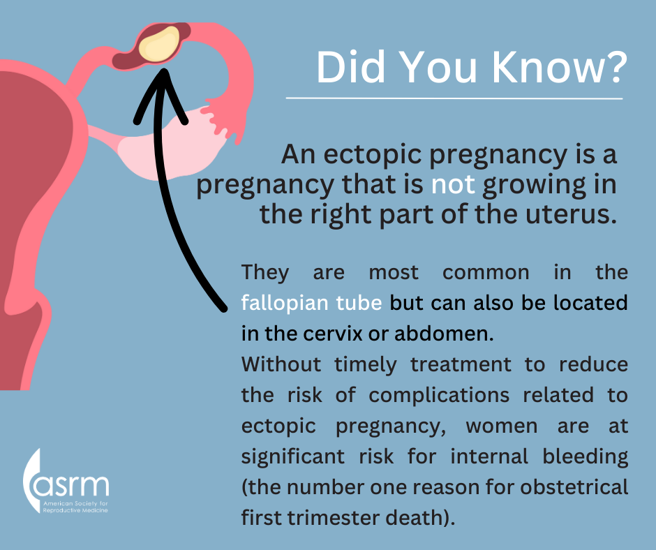 Ectopic Pregnancy 1.png