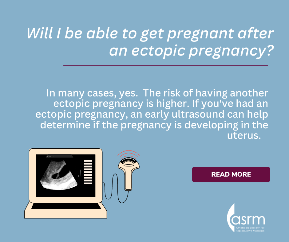 Ectopic Pregnancy 2.png