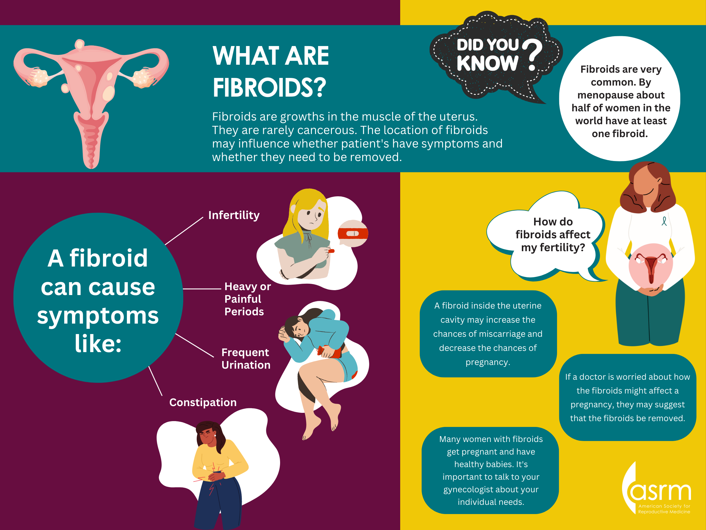 What are fibroids? | ReproductiveFacts.org