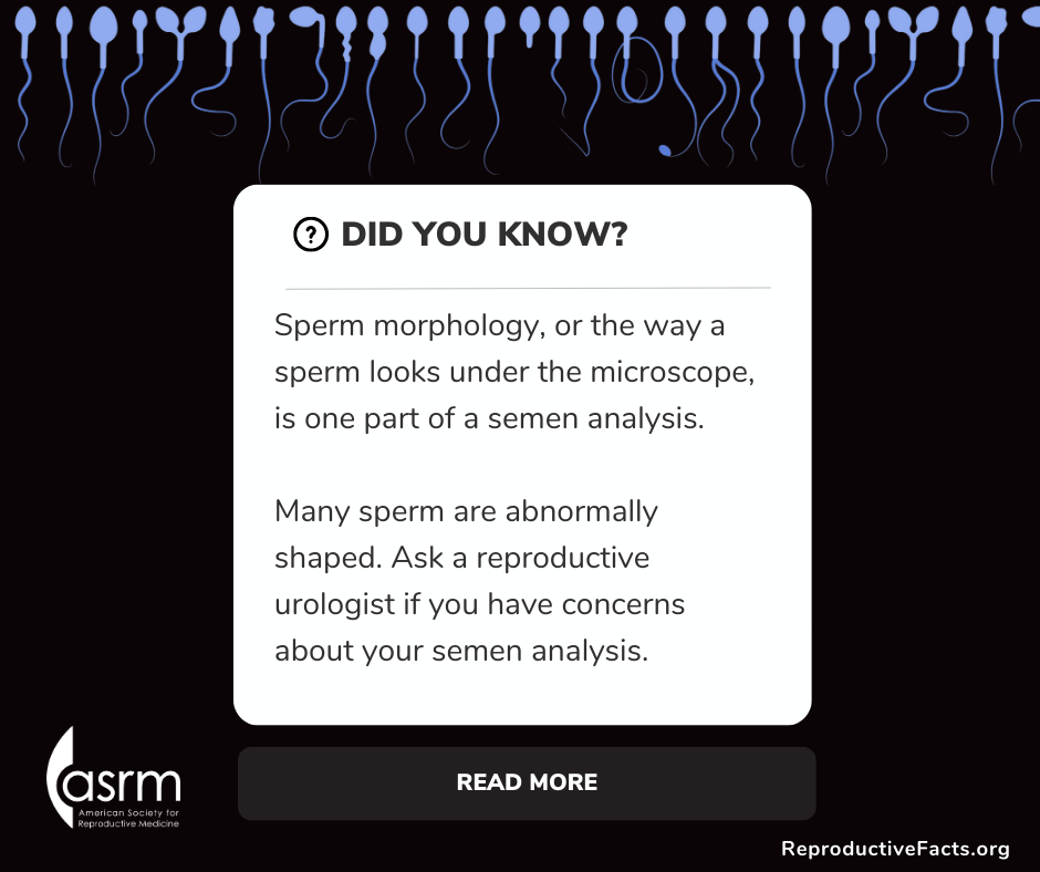 Sperm Shape.png