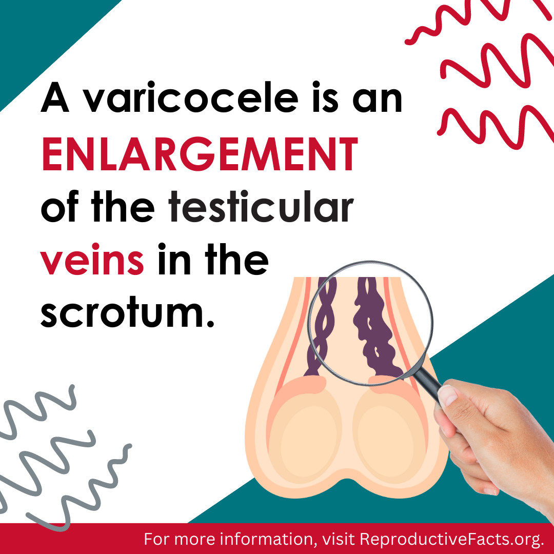 Varicocele 2.png